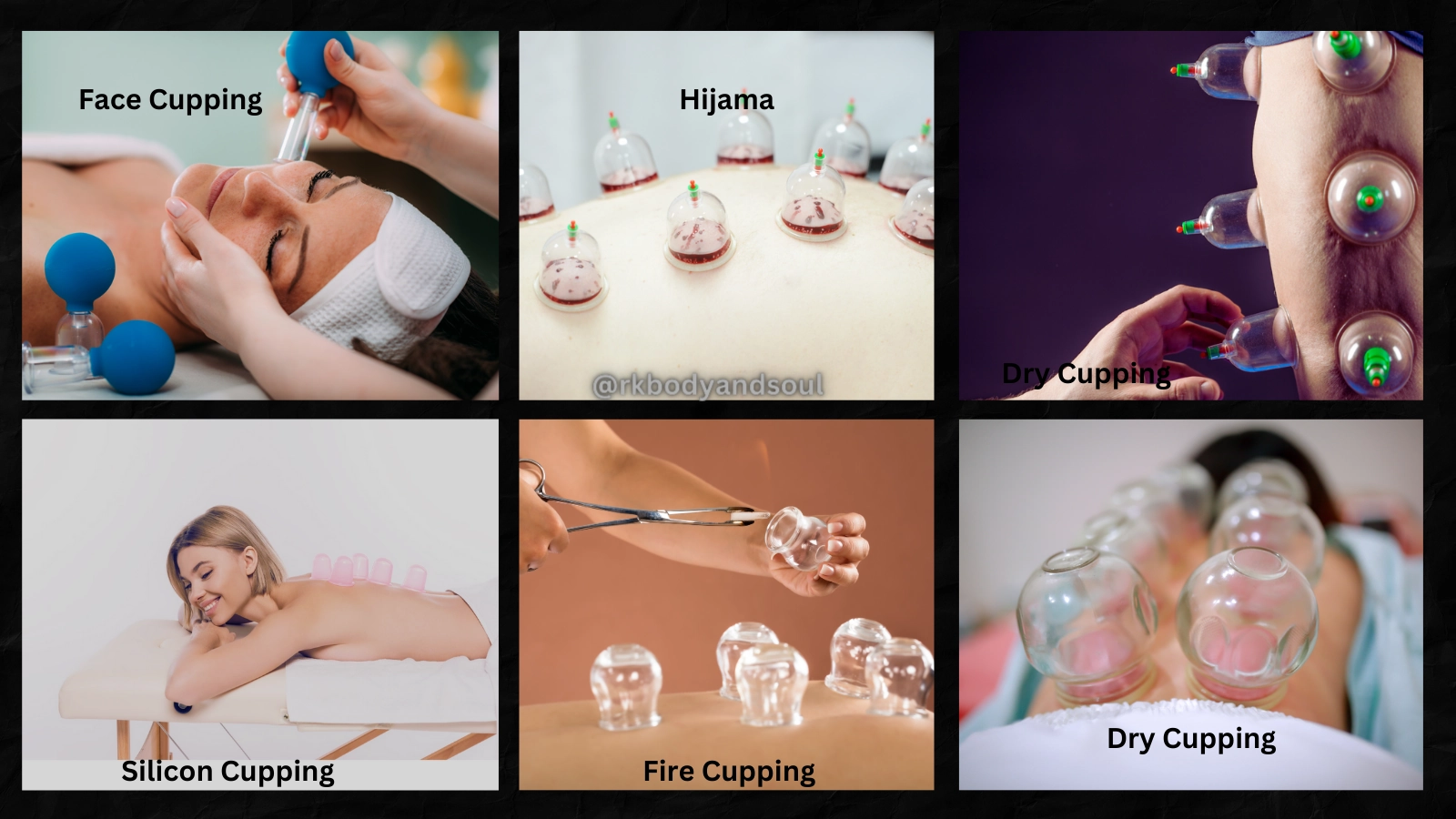 – cupping thearpy in hyderabad